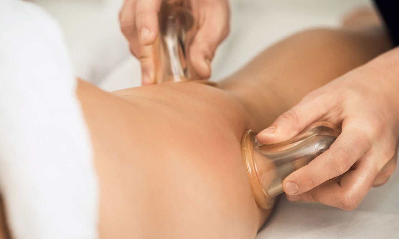 مساج الكاسات |CUPPING MASSAGE